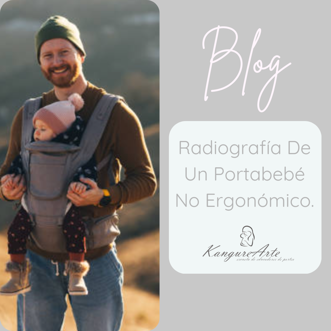 Imagen de portada del blog KangureArte que muestra un ejemplo visual de un portabebé no ergonómico (posición colona), con piernas estiradas y colgando. El texto de la imagen dice: Radiografía De Un Portabebé No Ergonómico.